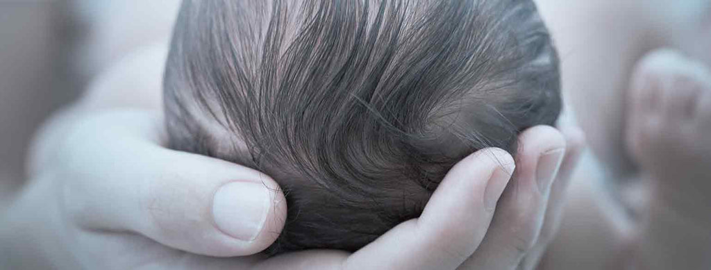 5 Steps to Treating Cradle Cap Naturally